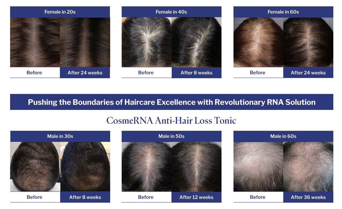 CosmeRNA before-and-after results — female and male cases over 8 to 36 weeks of use